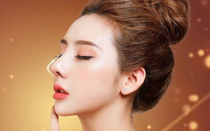 Làm mũi tại bác sĩ Hải Lê - bác sĩ nâng mũi giỏi ở Hà Nội (Nguồn: Internet)