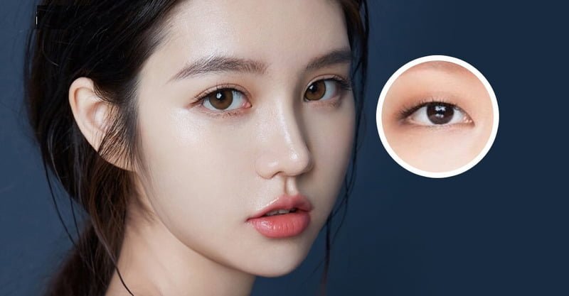 Ưu điểm vượt trội của bấm mí đa điểm (Nguồn: Internet)