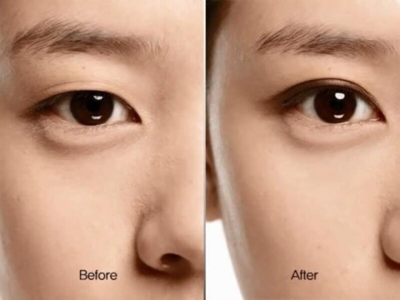 Thẩm Mỹ Viện Mailisa, địa chỉ bấm mí đa điểm Nghệ An (Nguồn: Internet)