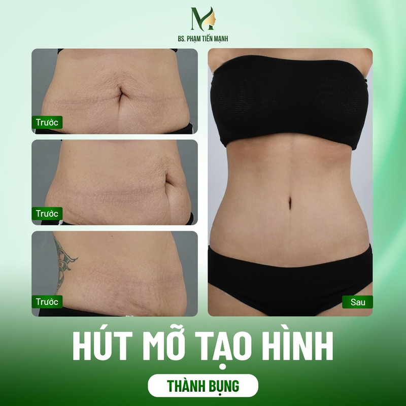 10 biến chứng phẫu thuật thẩm mỹ