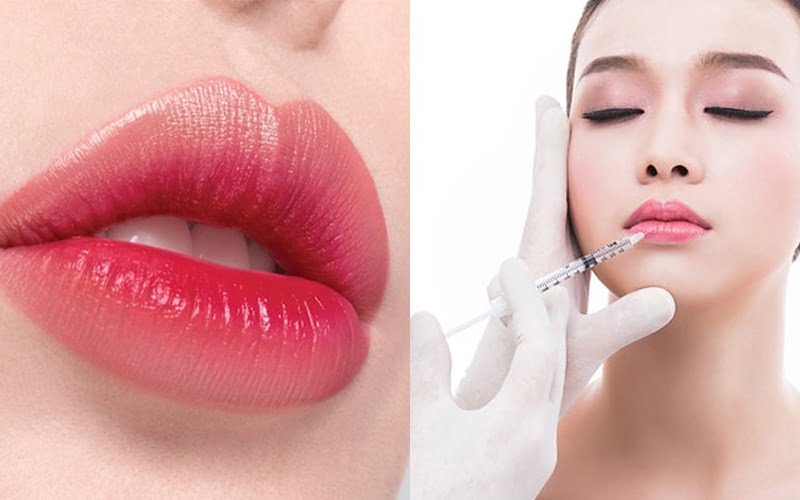 Cách có khóe miệng cười rạng rỡ, tươi tắn