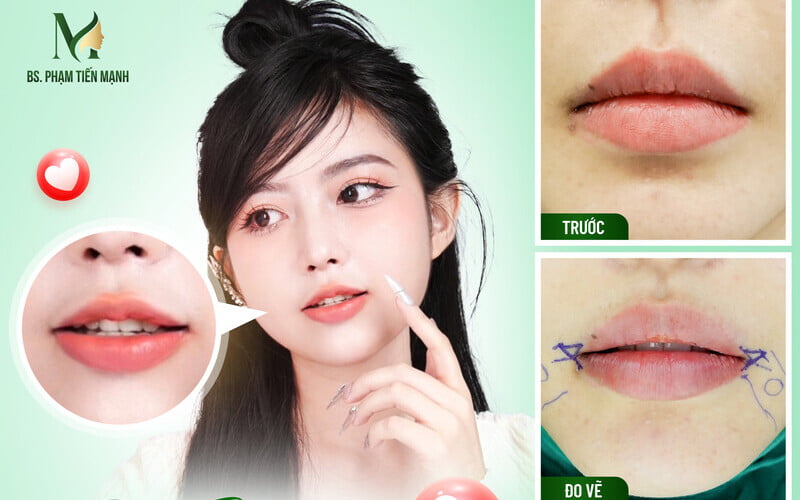 Cách có khóe miệng cười rạng rỡ, tươi tắn