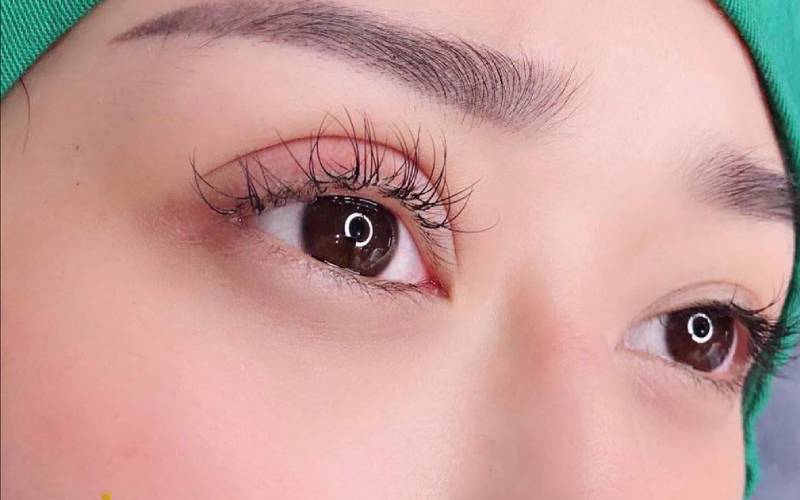 Hình ảnh cắt mí đẹp tại Thẩm mỹ MD Change Life (Nguồn: MD Change Life)