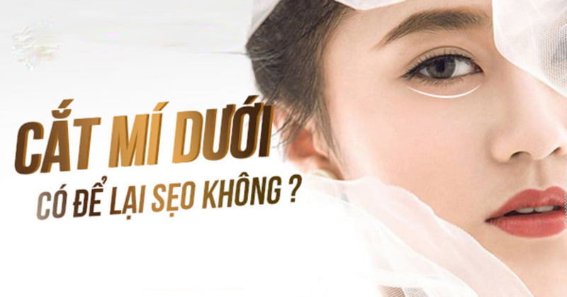 Cắt mí dưới có để lại sẹo không? (Nguồn: Internet)