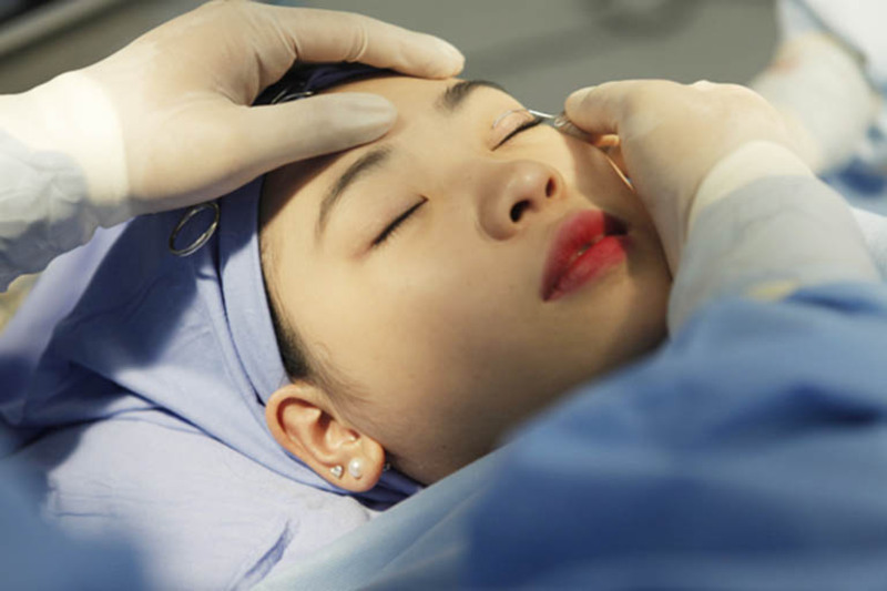 Xuân Hương: Địa chỉ cắt mí Hà Nội bằng công nghệ hiện đại (Nguồn:Internet)