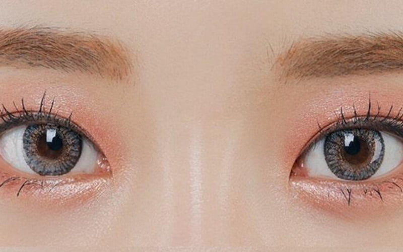 Cắt mí không nhắm được mắt phải làm sao?