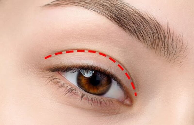 Lợi ích tuyệt vời của cắt mí mắt (Nguồn: Internet)