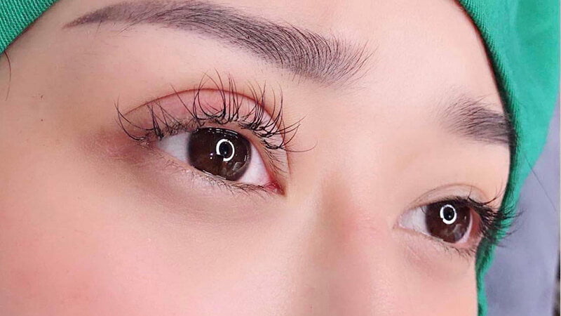 Sau khi cắt mí mắt đẹp phải tuân thủ đúng lời bác sĩ (Nguồn: Internet)