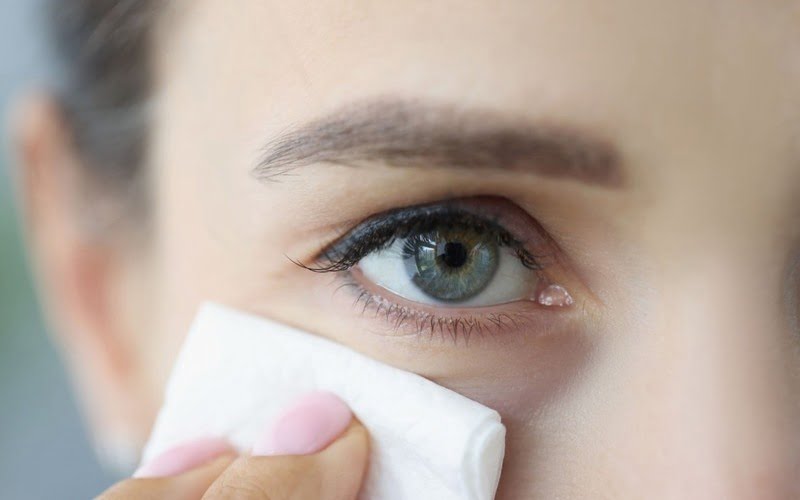 Cắt mí nên ăn gì cho mau lành? Top 4 thực phẩm tốt cho người cắt mí