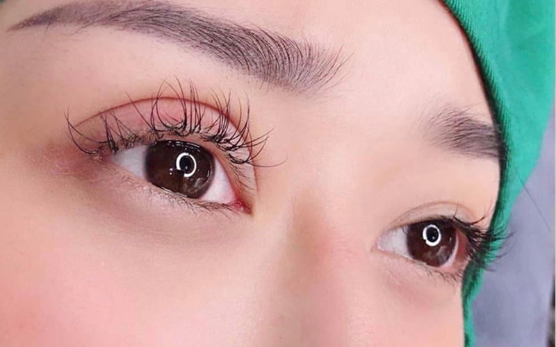 Quy trình cắt mí mắt đẹp, chuyên nghiệp ở Thẩm Mỹ MD Change Life (Nguồn: Internet)