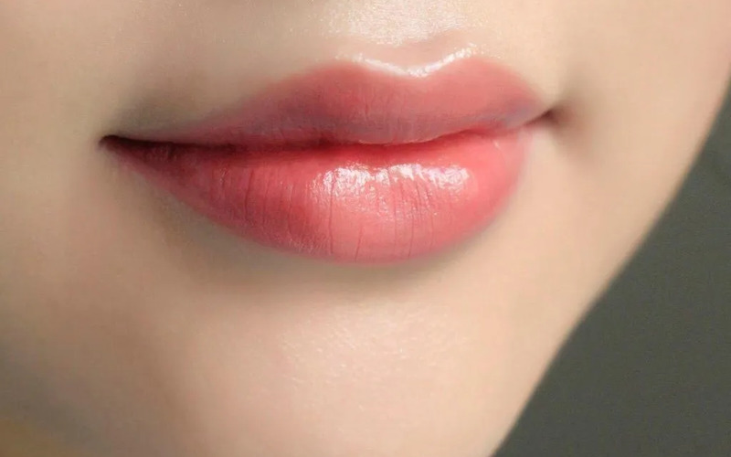 Cắt môi cười (Nguồn: Internet)