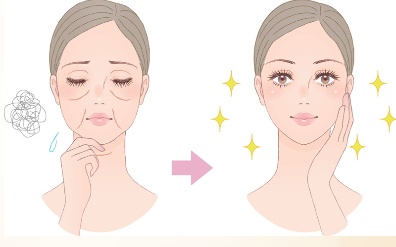 Cấy mỡ má (Nguồn: Internet)