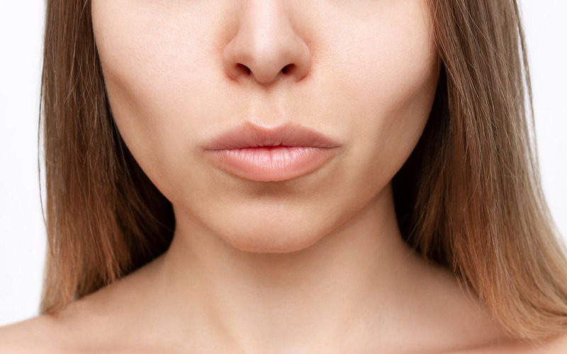 Má hóp nên cần cấy mỡ cải thiện (Nguồn: Internet)