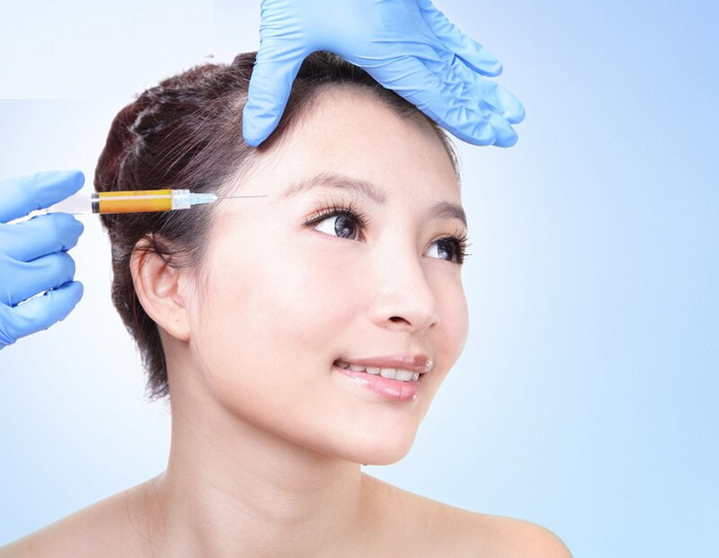 Cấy mỡ mắt là gì? (Nguồn: Internet)