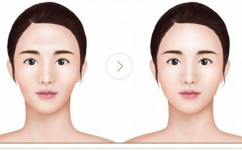 Cấy mỡ mặt là phương pháp thẩm mỹ phù hợp cho cả nam và nữ từ 18 tuổi trở lên, gặp phải các vấn đề da mặt (Nguồn: Internet)