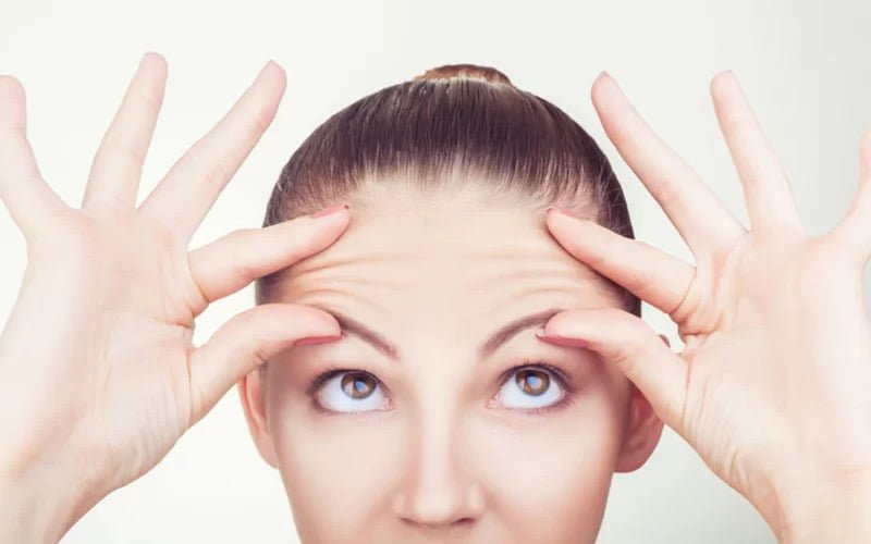 Không nhăn mặt sau cấy mỡ mặt (Nguồn: Internet)