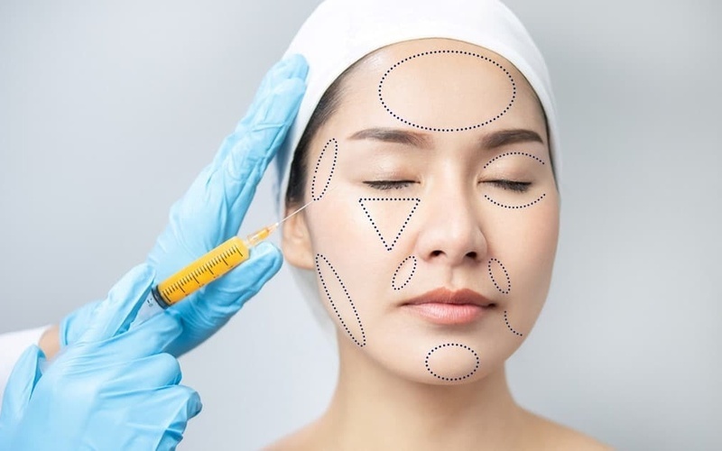 Top 6 địa chỉ cấy mỡ mặt tốt nhất Nghệ An