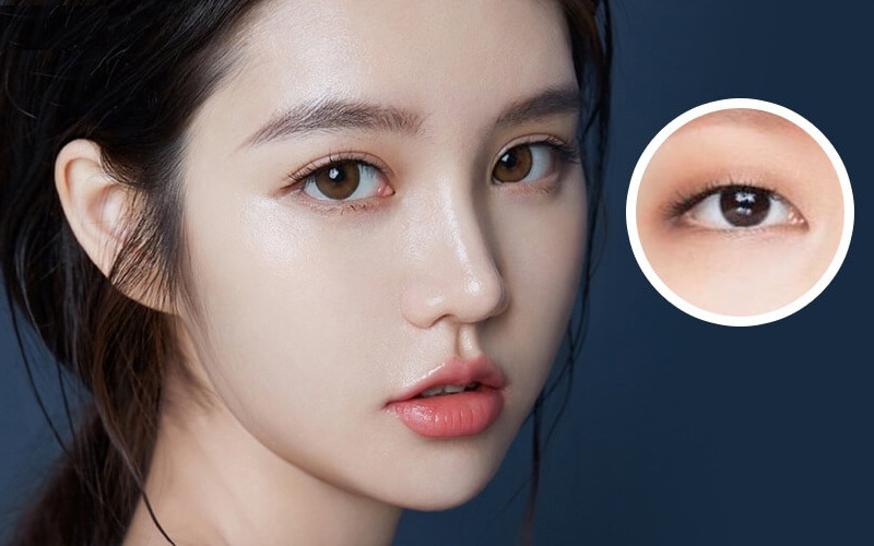 Top 5 địa chỉ cấy mỡ mắt uy tín nhất tại Nghệ An