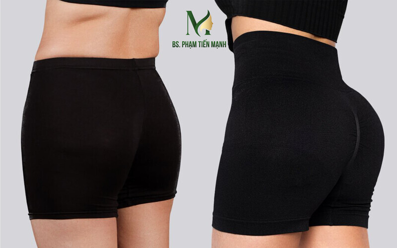 5 địa chỉ cấy mỡ mông bằng mỡ tự thân Hà Nội