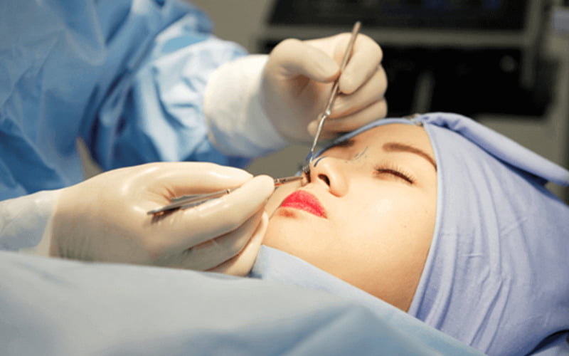 Chỉnh hình mũi hở do tai nạn (Nguồn: Internet)