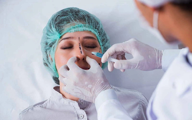 Phẫu thuật vách ngăn, chỉnh hình mũi (Nguồn: Internet)