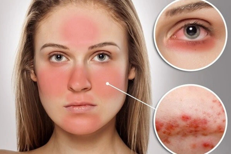 Có nên tiêm gọn hàm không? Lời khuyên từ chuyên gia