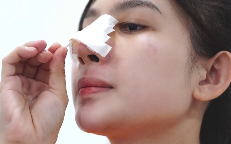 Vệ sinh mũi sạch sẽ (Nguồn: Internet)