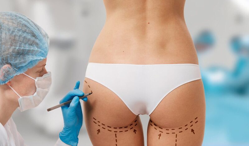 Sử dụng phương pháp cấy mỡ tự thân cải thiện vòng 3 trông căng tròn hơn (Nguồn: Internet)