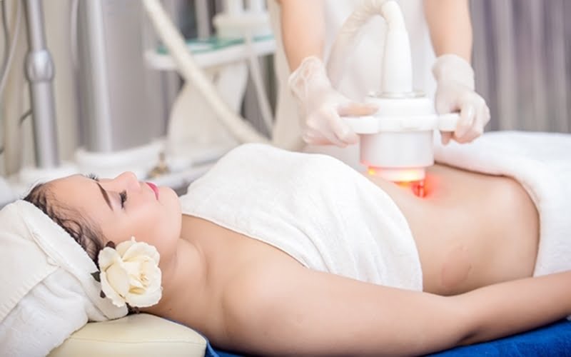 Hút mỡ có hỗ trợ laser (LAL) (Nguồn: Internet)