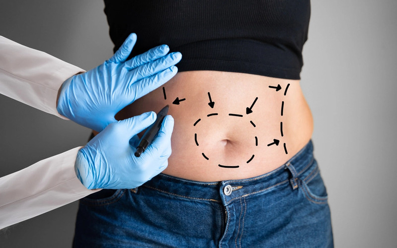 Vị trí hút mỡ khác nhau thì chi phí khác nhau (Nguồn: Internet)