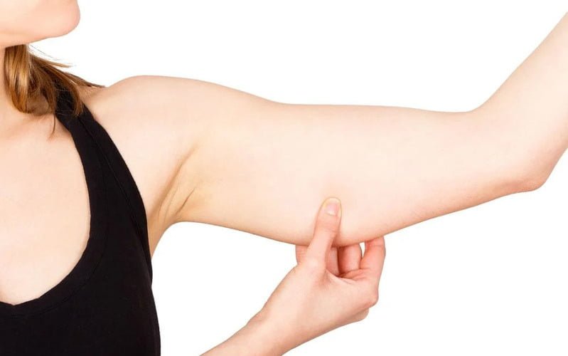 Hút mỡ cánh tay là phương pháp thẩm mỹ làm đẹp với nhiều điểm nổi bật (Nguồn: Internet)
