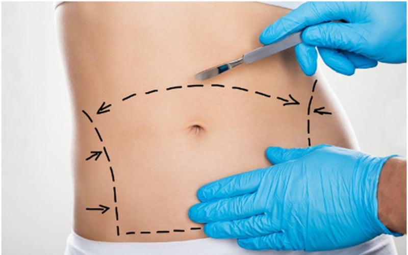 Các rủi ro và biến chứng tiềm ẩn nếu lựa chọn cơ sở không uy tín (Nguồn: Internet)