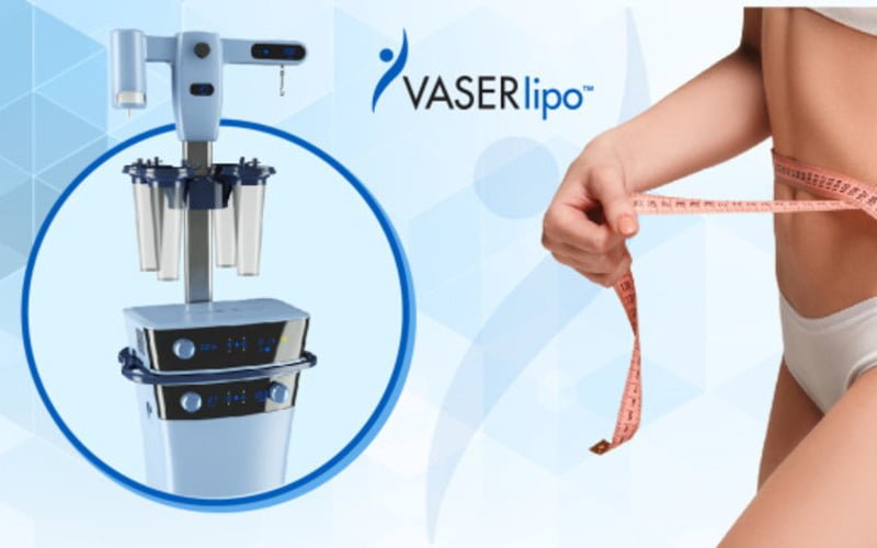 Hút mỡ Vaser (Nguồn: Internet)