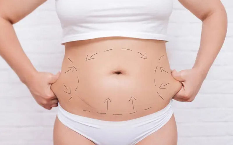 Top 10 Thẩm mỹ viện hút mỡ uy tín tại Hà Nội 2024