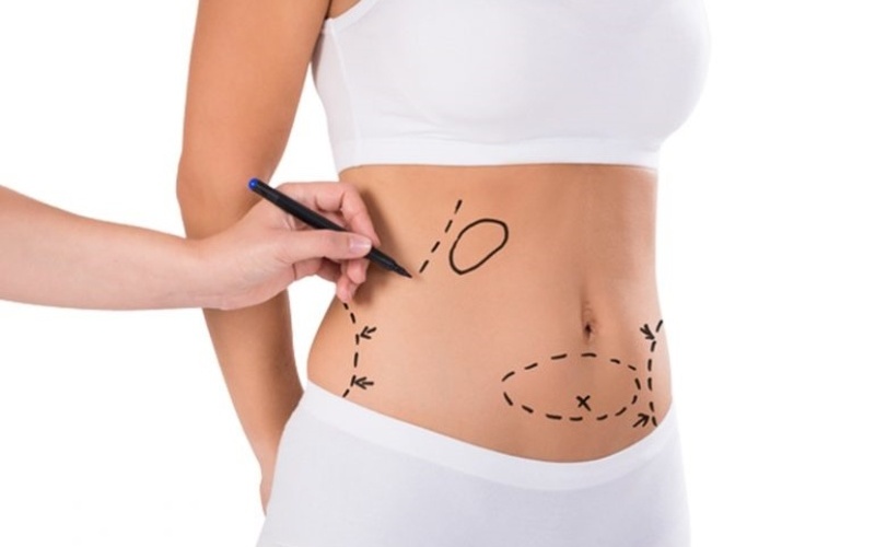 Top 8 địa chỉ hút mỡ uy tín nhất tại Nghệ An – Giúp bạn lấy lại vóc dáng mơ ước