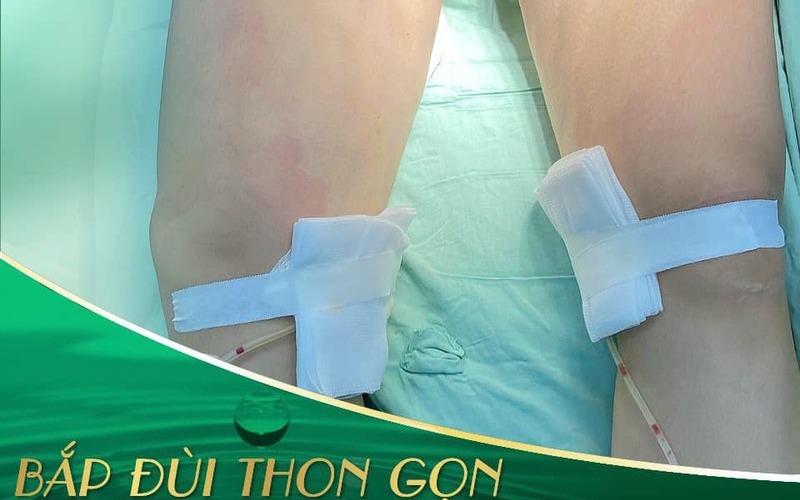 Top 8 địa chỉ hút mỡ uy tín nhất tại Nghệ An – Giúp bạn lấy lại vóc dáng mơ ước