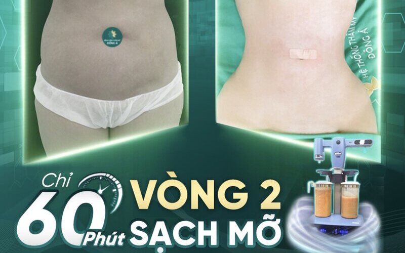 Top 8 địa chỉ hút mỡ uy tín nhất tại Nghệ An – Giúp bạn lấy lại vóc dáng mơ ước