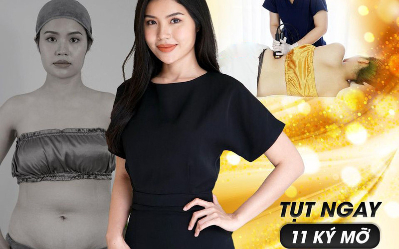 Top 8 địa chỉ hút mỡ uy tín nhất tại Nghệ An – Giúp bạn lấy lại vóc dáng mơ ước