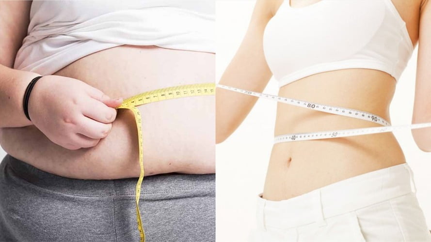 Eo thon gọn sau hút mỡ (Nguồn: Internet)