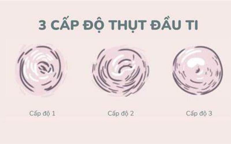 Kéo núm vú: Giải pháp tối ưu cho vòng 1 hoàn hảo