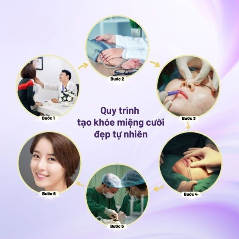 Tìm hiểu về phương pháp tạo khóe miệng cười (Nguồn:Internet)