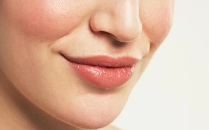 Tạo khóe cười giúp nụ cười trở nên tươi tắn hơn ( Nguồn : Internet )