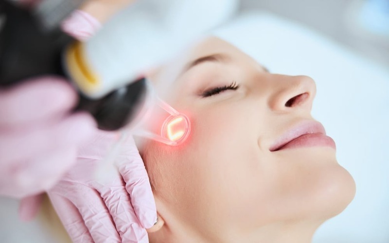 Laser trẻ hóa da (Nguồn: Internet)