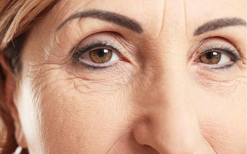 Gương mặt già đi do nếp nhăn cau mày (Nguồn: Internet)