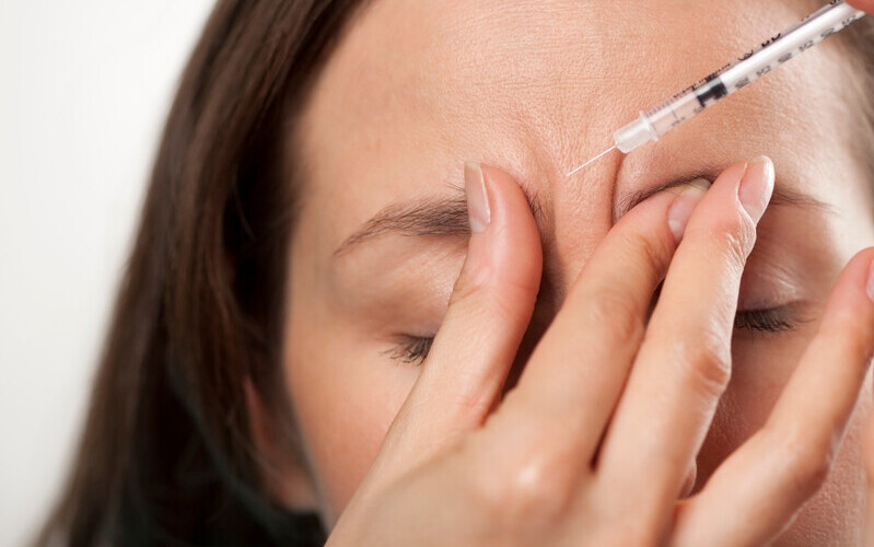 Tiêm Filler xóa nhăn cau mày (Nguồn: Internet)