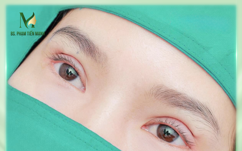 5 địa chỉ mở khóe mắt Hà Nội uy tín 2024