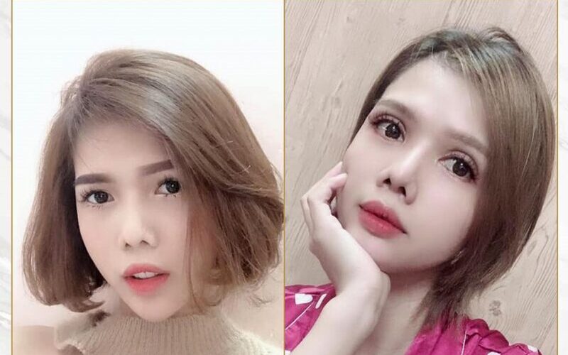 Địa chỉ mở khoé mắt Hà Nội đẹp: Thẩm mỹ Tấm (Nguồn: Internet)