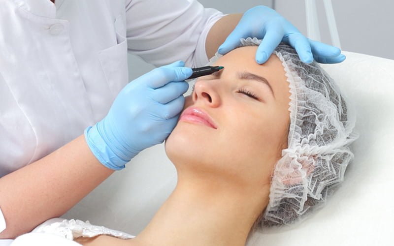 Nâng cung chân mày phẫu thuật mang lại hiệu quả lâu dài hơn so với nâng cung chân mày bằng chỉ, nhưng cần thời gian hồi phục lâu hơn (Nguồn: Internet)