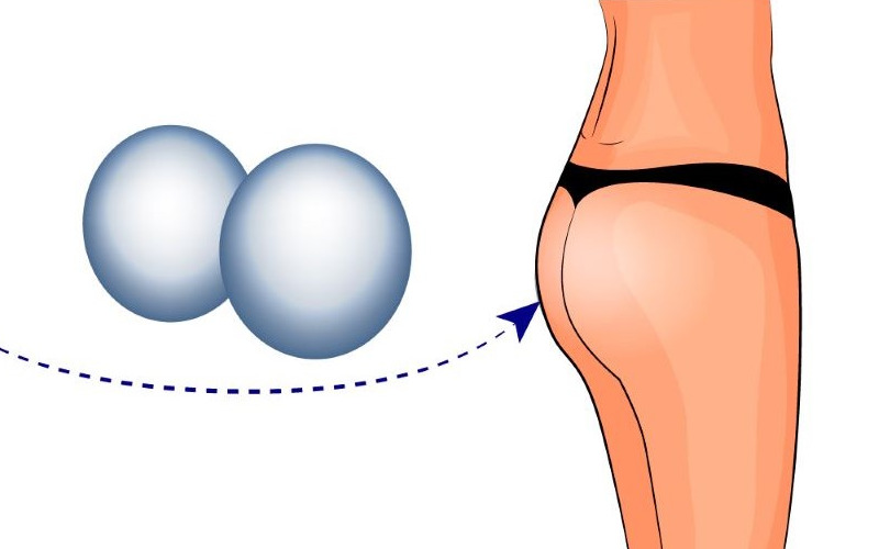 Nâng Mông Nội Soi – Bí Quyết V3 Quyến Rũ