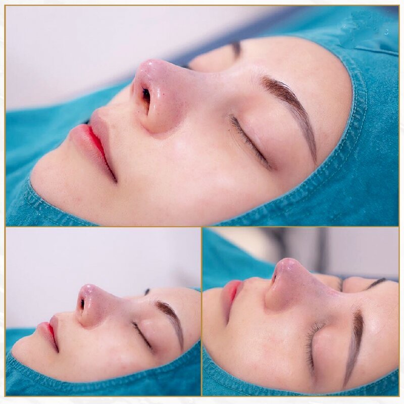 Nâng mũi cấu trúc giúp bạn hết tự ti, có được nhiều cơ hội (Nguồn: Internet)